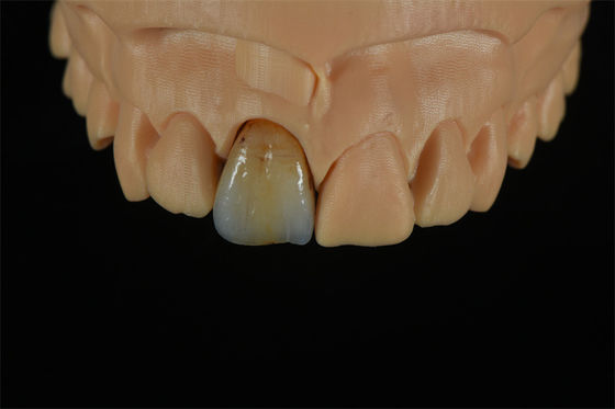جودة  Affordable Zirconia Crowns with Custom Color Staining - China Dental Lab مصنع